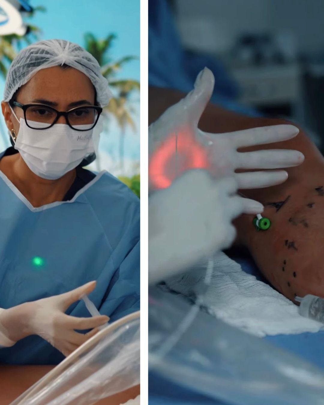 No momento, você está visualizando Laser Endovenoso para Veia Safena: tratamento moderno sem cortes